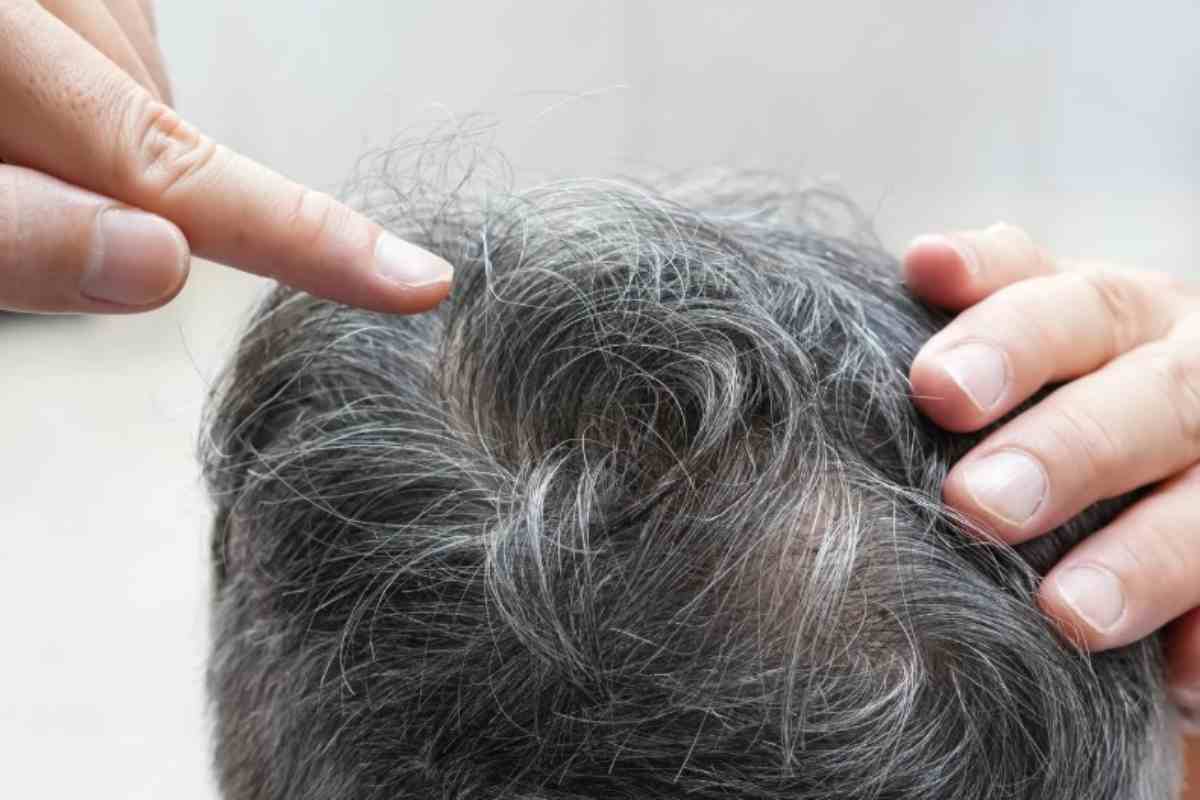Ricrescita capelli bianchi