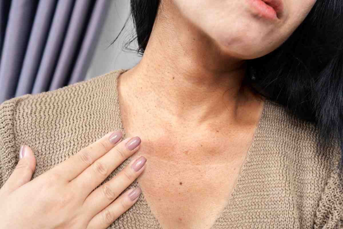 come eliminare le rughe sul collo