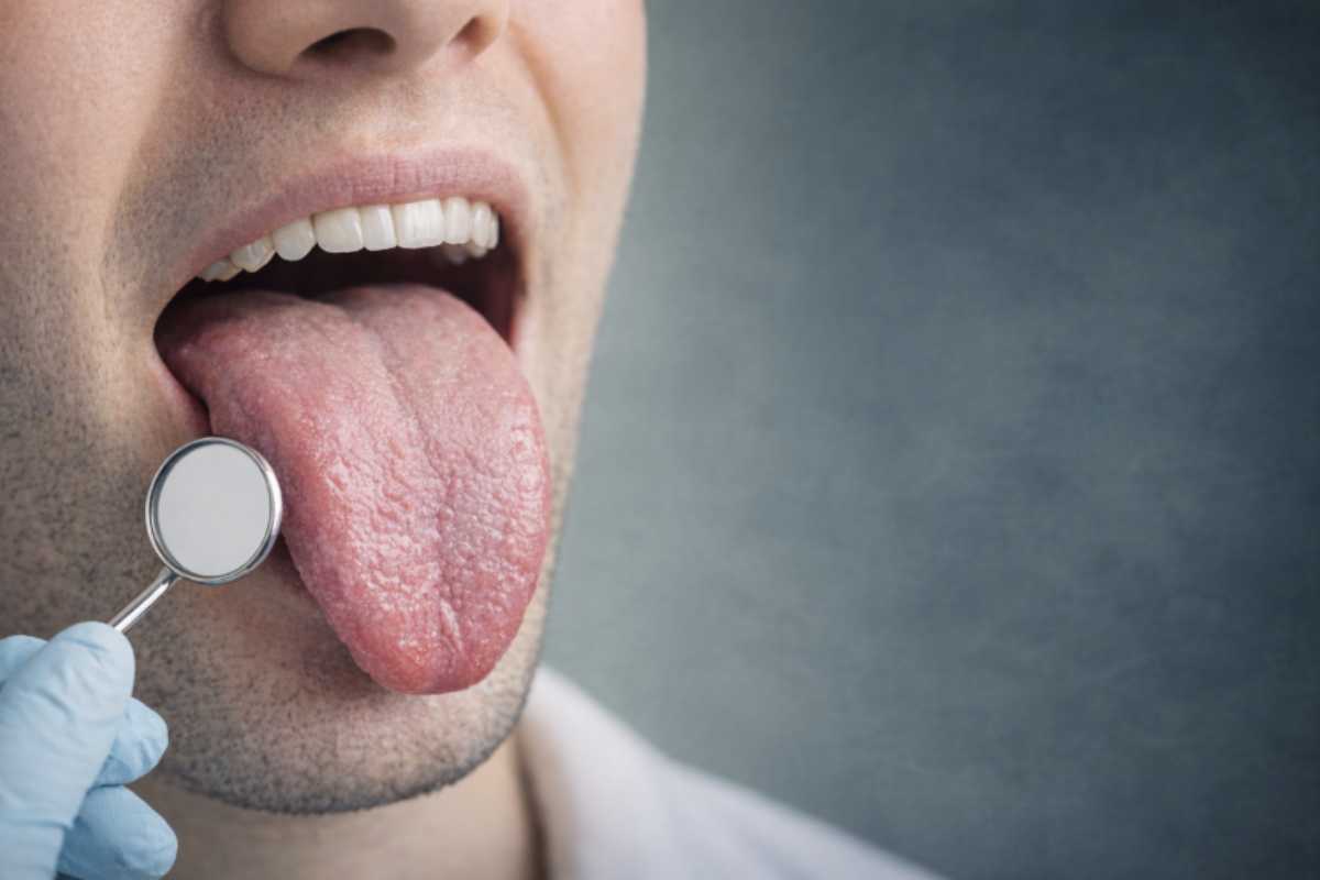 Questo tessuto altamente vascolarizzato e innervato non è solo essenziale per funzioni come il gusto e la deglutizione